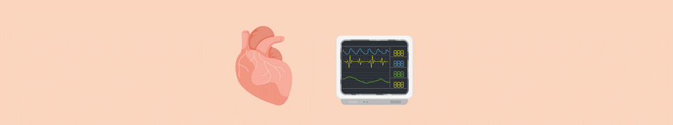 Fick Cardiac Output Calculator
